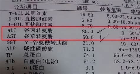 谷丙转氨酶正常值