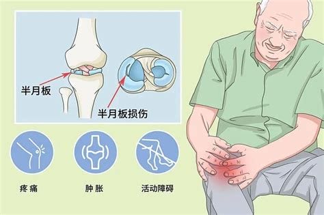 膝关节疼痛原因是什么