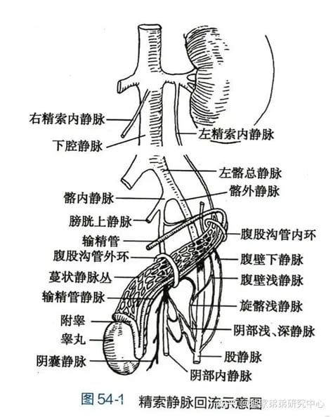 精索静脉曲张是怎么样引起的