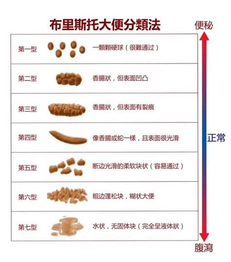 便秘一直放屁不拉屎是什么病