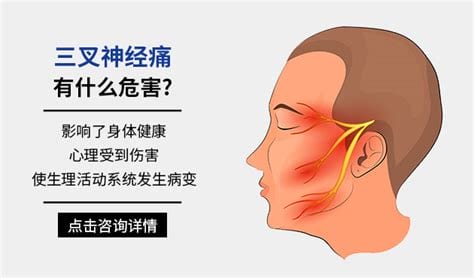 神经痛是由于什么原因引起的